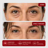 Avant / après 2 semaines d'utilisation du masque Luumia sur les cernes