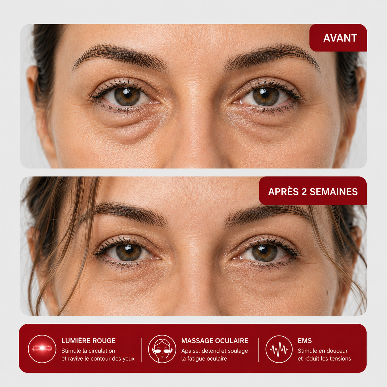 Avant / après 2 semaines d'utilisation du masque Luumia sur les cernes